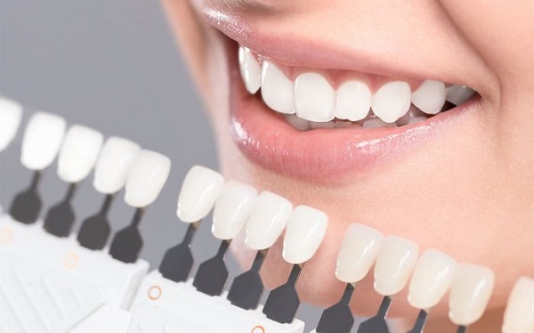 Quy trình tẩy trắng răng theo tiêu chuẩn của Bộ Y tế