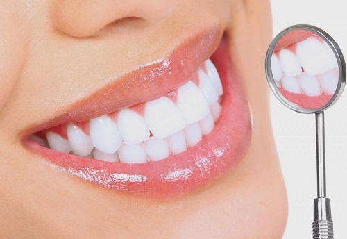 Tẩy trắng răng có bị mòn răng không? 