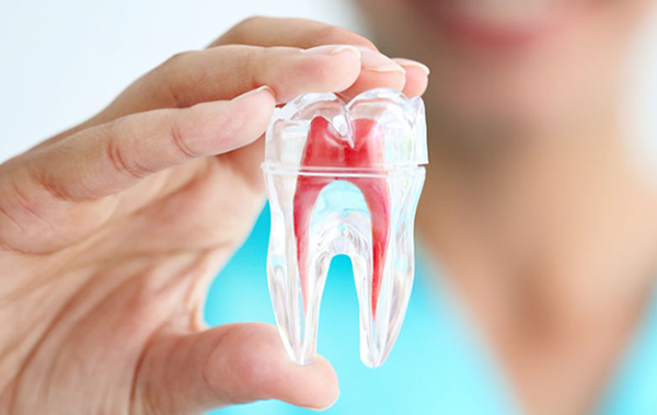 Trám răng có cần lấy tủy không?
